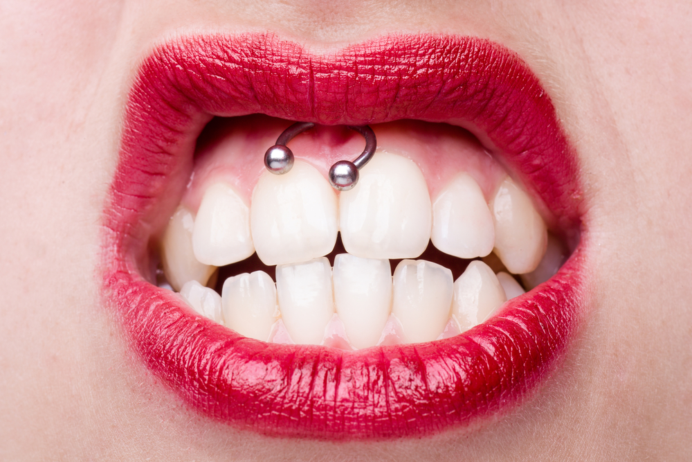 Risks of oral piercings - Clínica Pardiñas